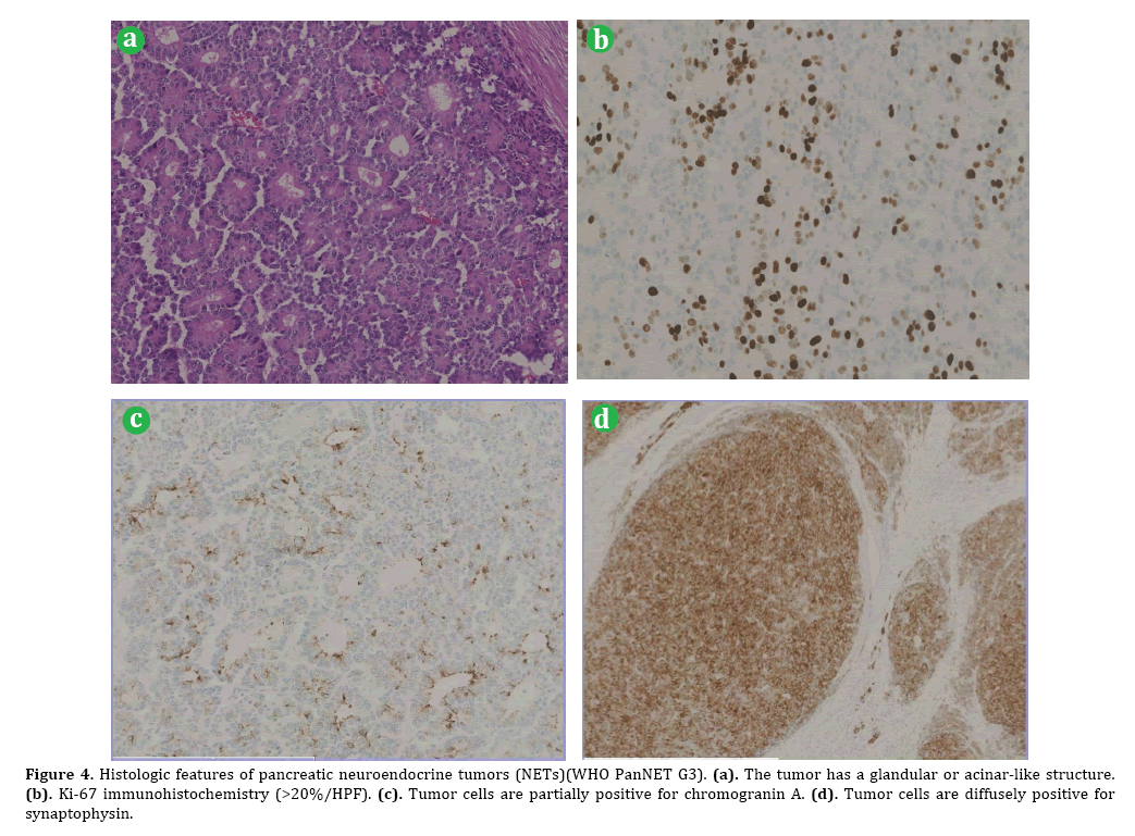 generalized-theory-applications-tumors