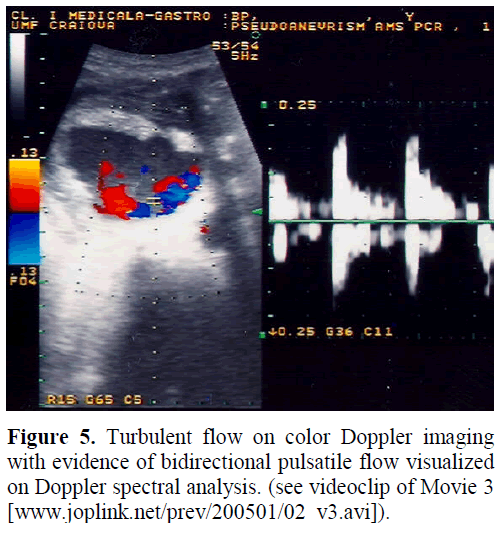 pancreas-turbulent-flow-color-doppler