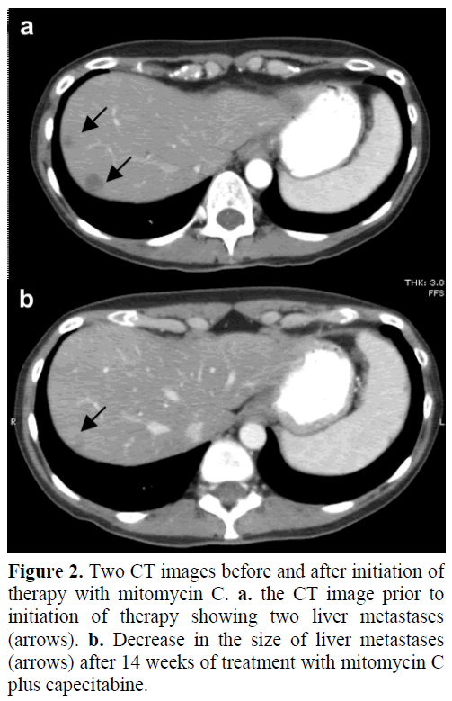 pancreas-two-ct-images-initiation