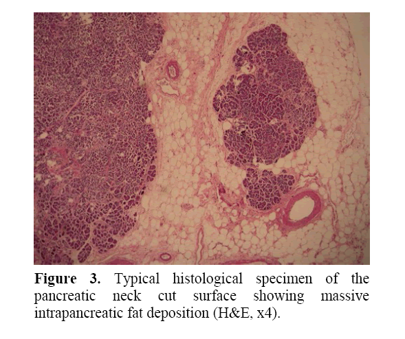 pancreas-typical-histological-specimen