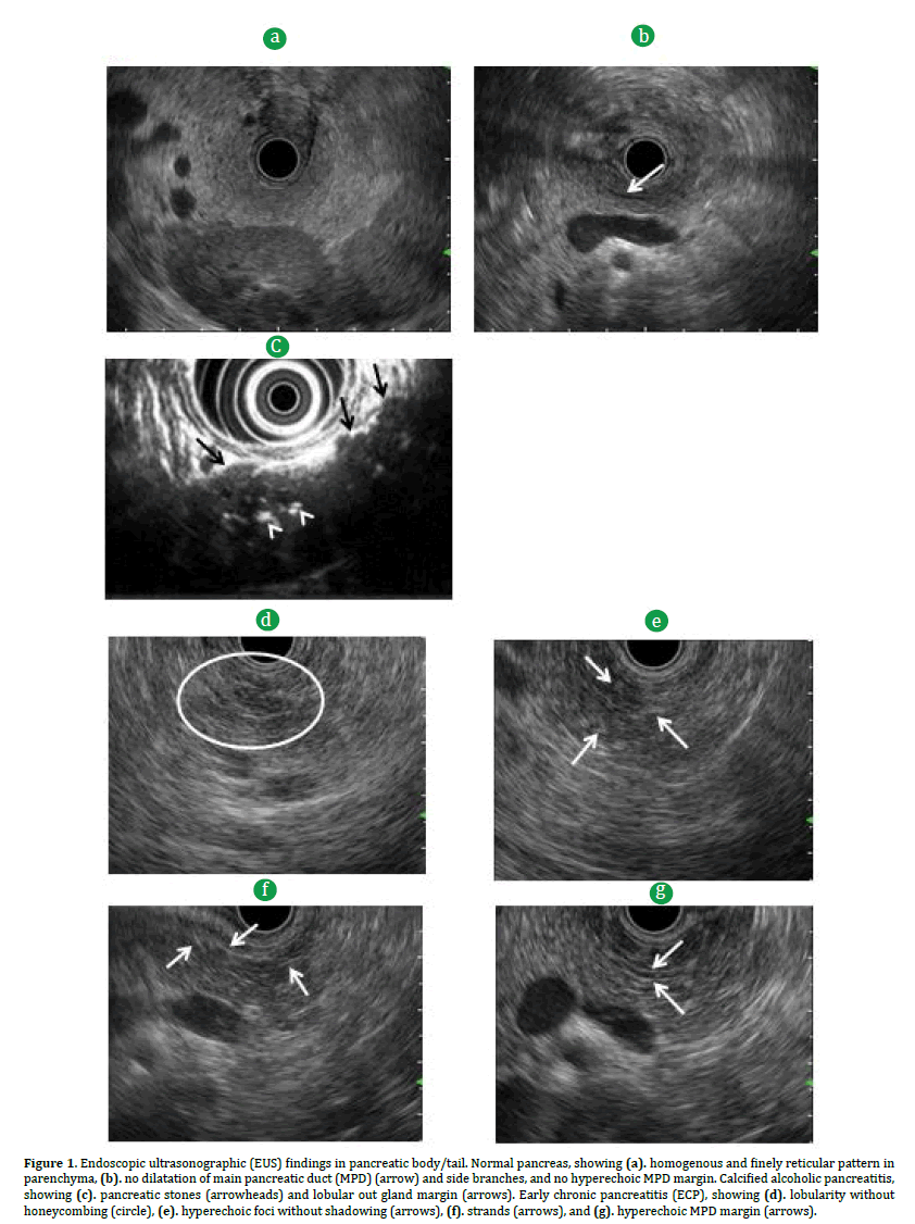 pancreas-ultrasonographic