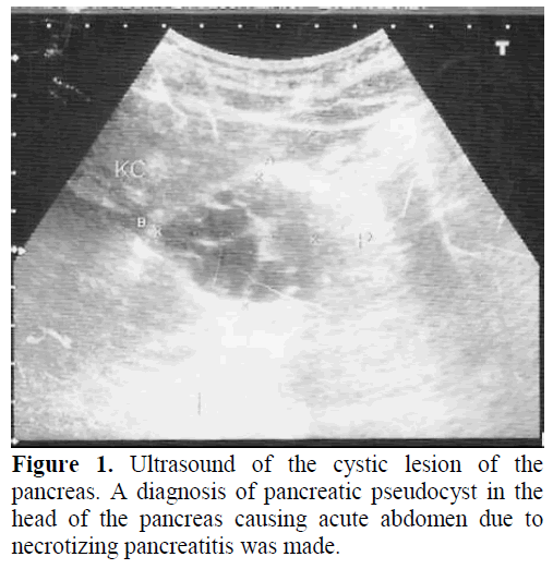 pancreas-ultrasound-cystic-lesion
