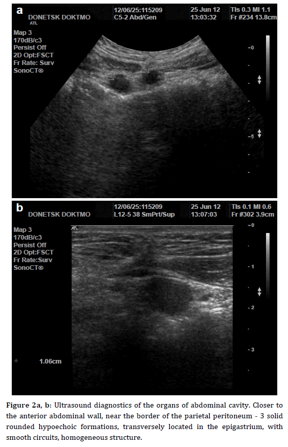 pancreas-ultrasound-diagnostics-organs