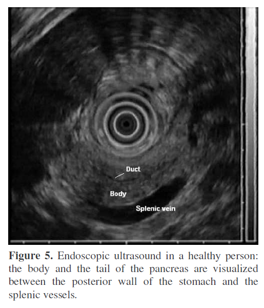 pancreas-ultrasound-healthy-person