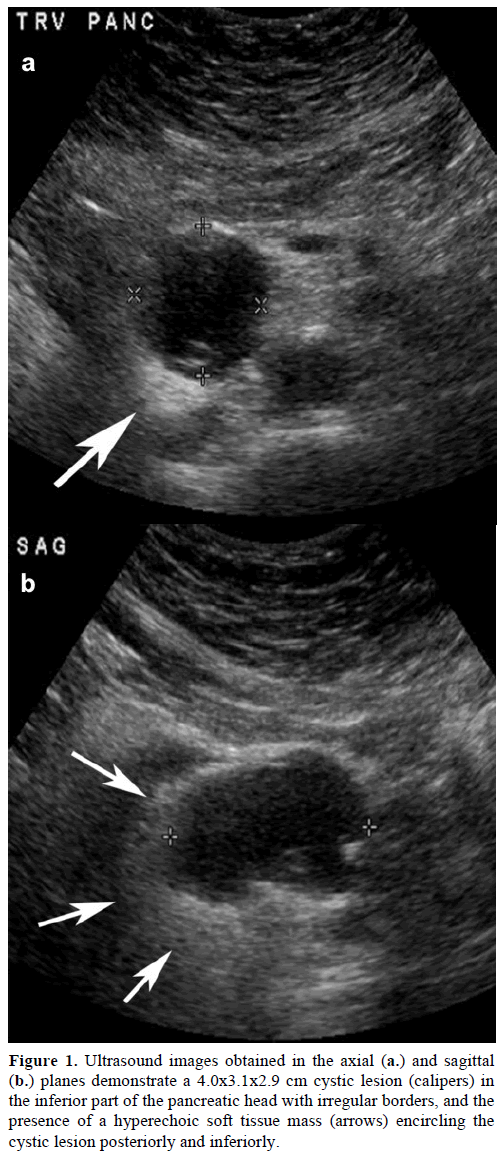 pancreas-ultrasound-images-obtained