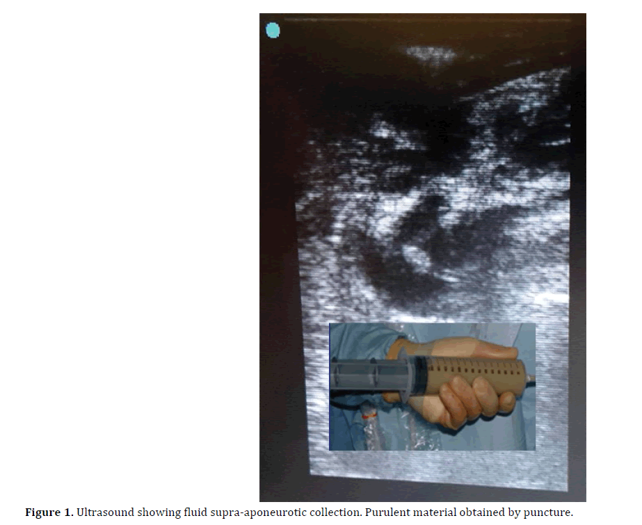 pancreas-ultrasound-supra-aponeurotic