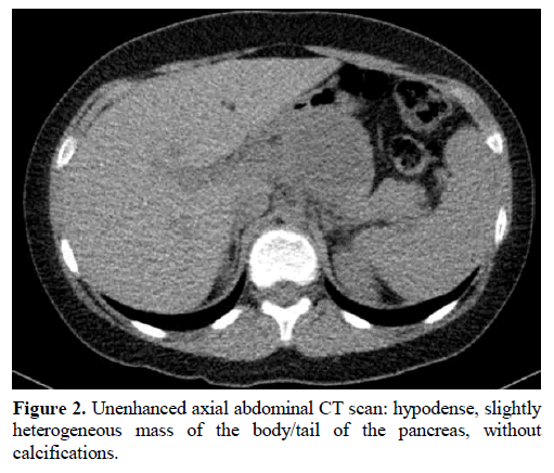 pancreas-unenhanced-axial-abdominal