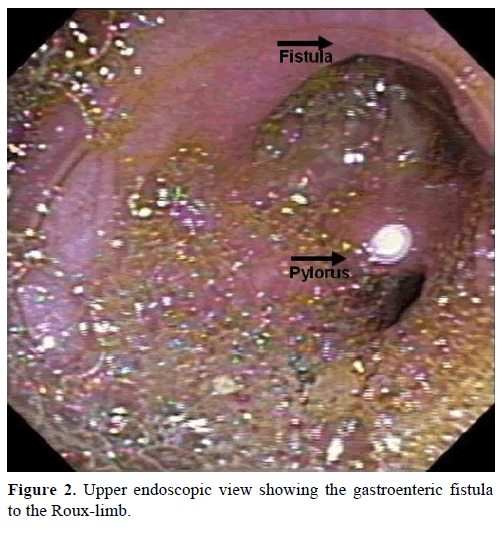 pancreas-upper-endoscopic-view