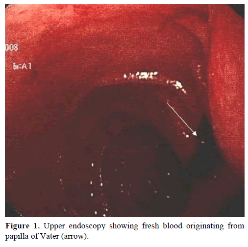 pancreas-upper-endoscopy-fresh-blood