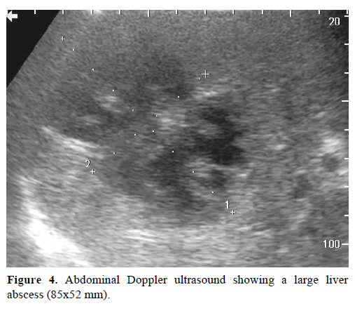 pancreas-upper-endoscopy-fresh-blood