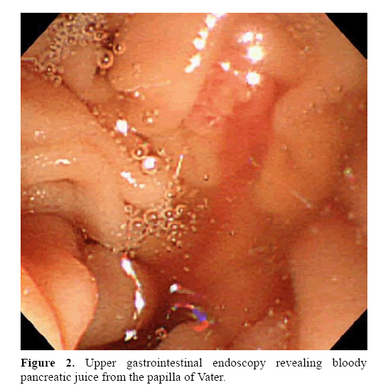 pancreas-upper-gastrointestinal-endoscopy