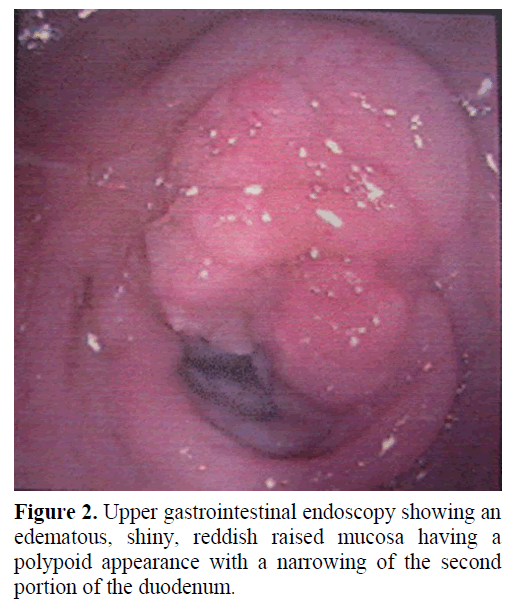 pancreas-upper-gastrointestinal-endoscopy