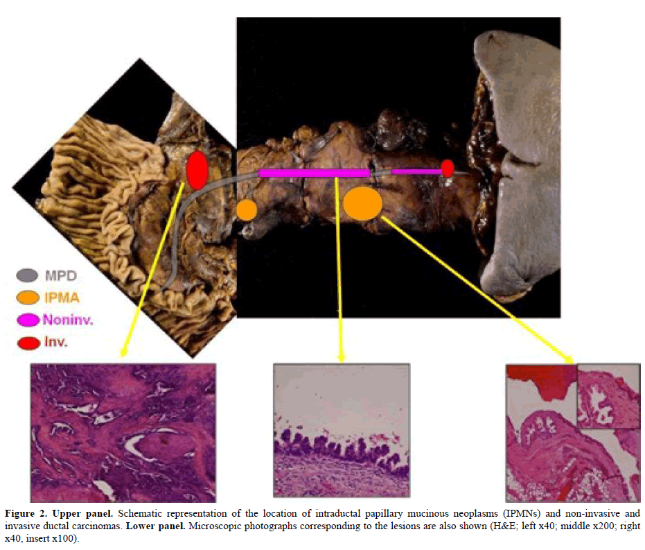 pancreas-upper-panel-Schematic-representation