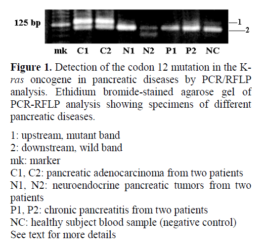 pancreas-upstream-mutant-band