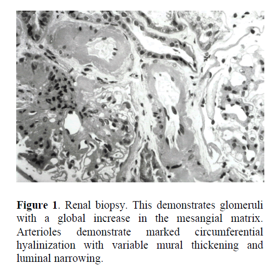 pancreas-variable-mural-thickening