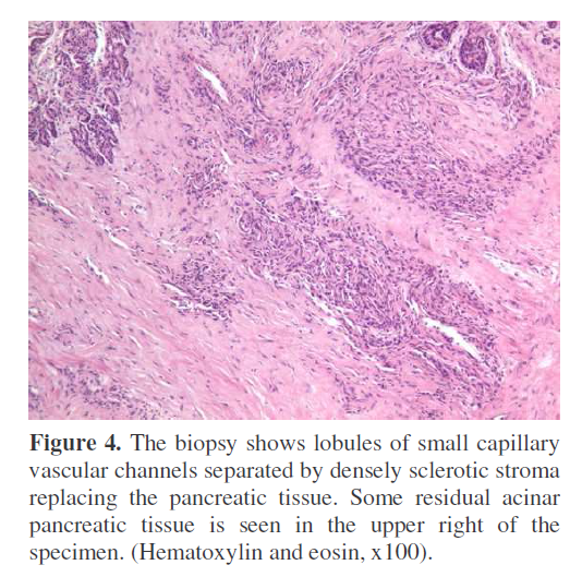 pancreas-vascular-channels-separated