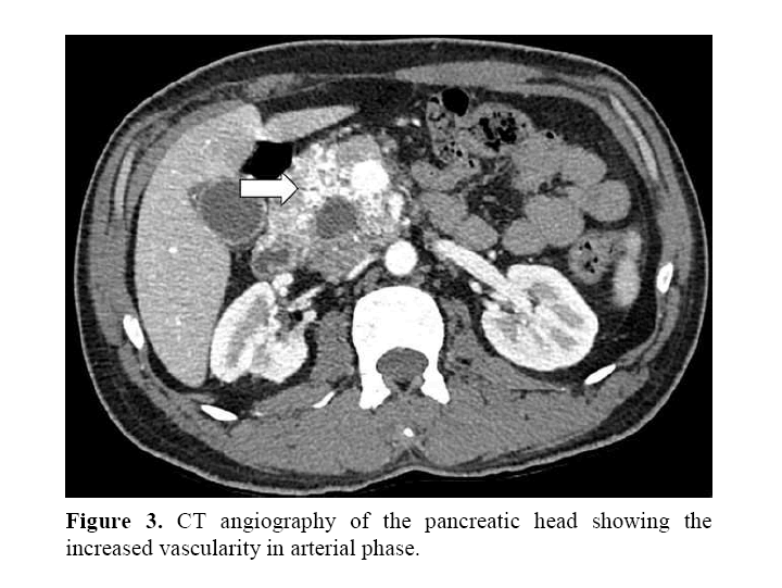 pancreas-vascularity-arterial-phase