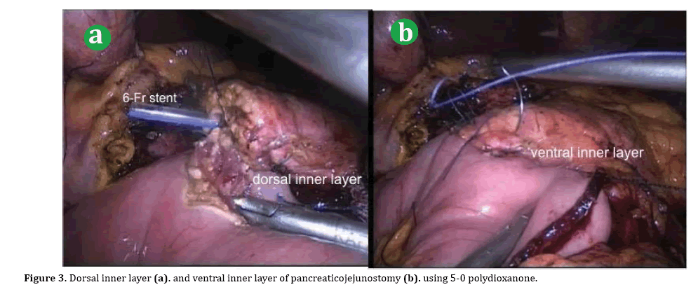 pancreas-ventral