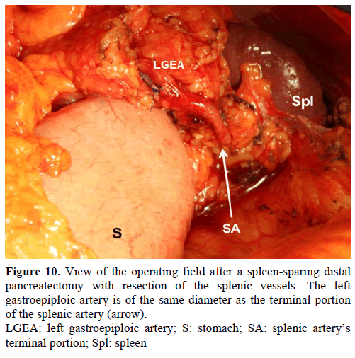 pancreas-view-operating-field
