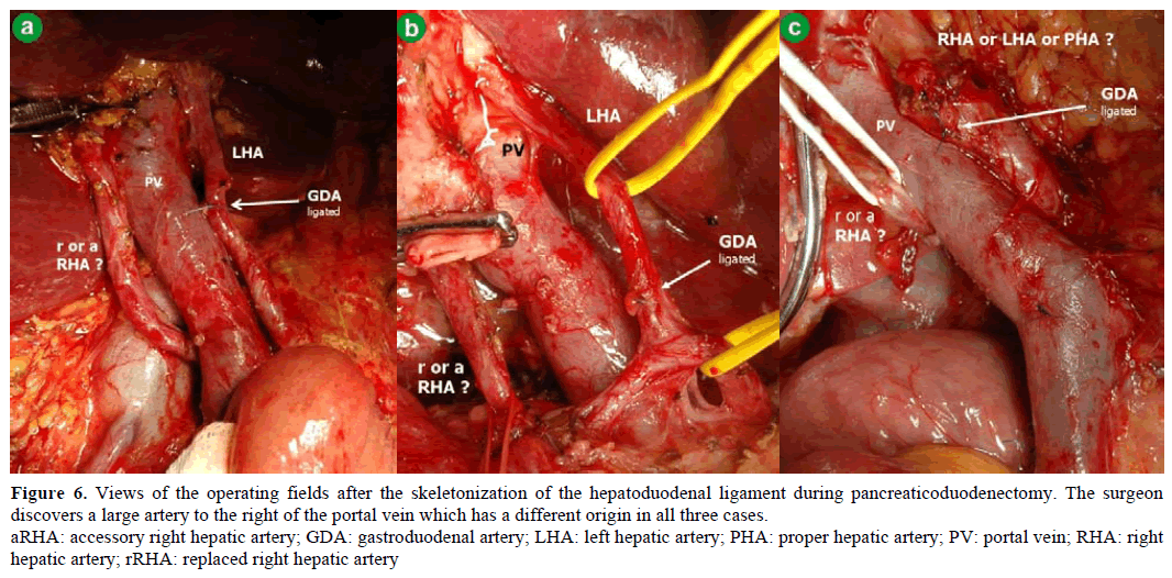 pancreas-views-operating-fields-skeletonization