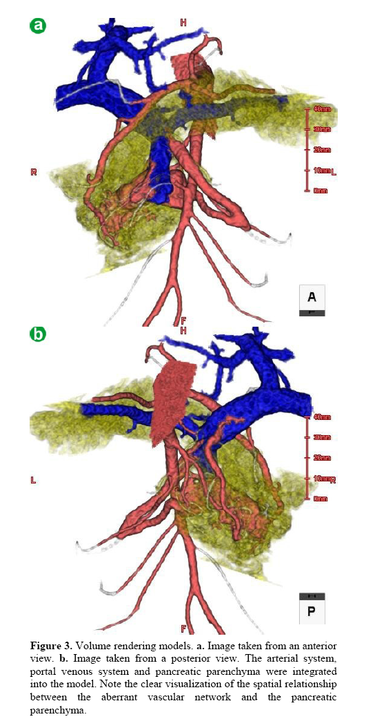 pancreas-volume-rendering-models