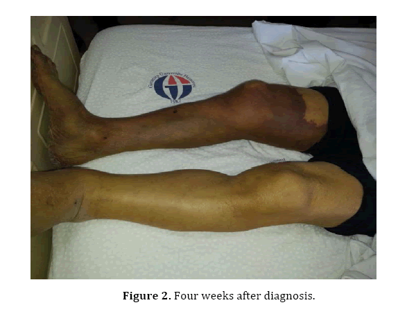 pancreas-weeks-after-diagnosis