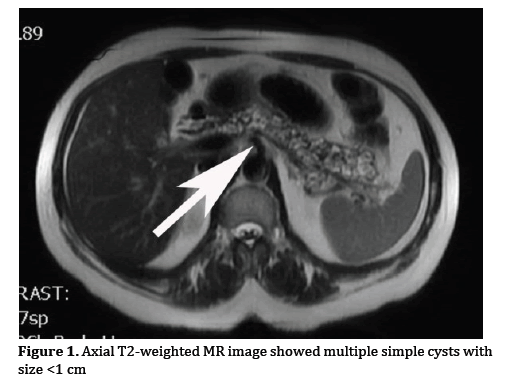 pancreas-weighted