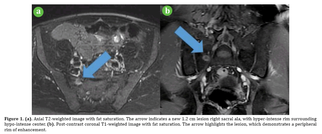 pancreas-weighted