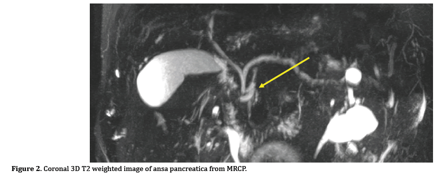 pancreas-weighted