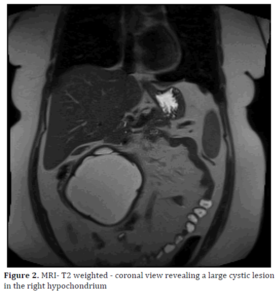 pancreas-weighted-coronal-view