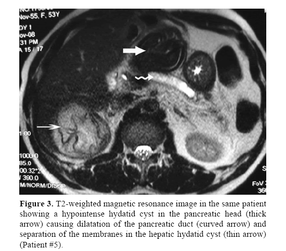 pancreas-weighted-magnetic-resonance