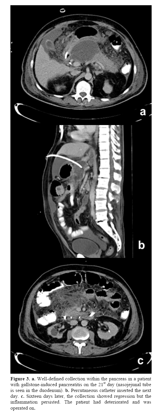 pancreas-well-defined-collection