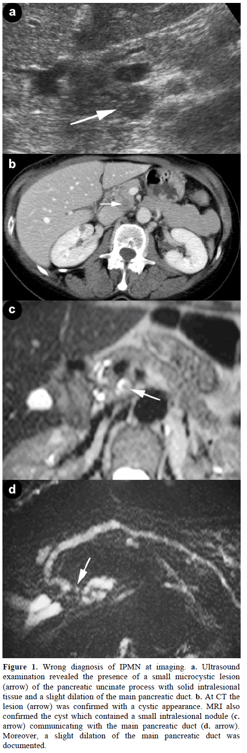 pancreas-wrong-diagnosis-ipmn-imaging