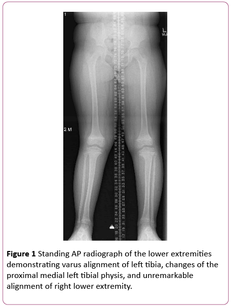 pediatrics-health-research-AP-radiograph