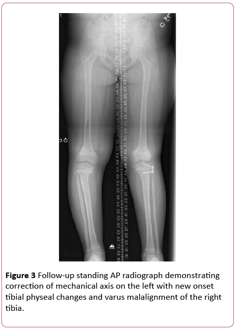 pediatrics-health-research-AP-radiograph