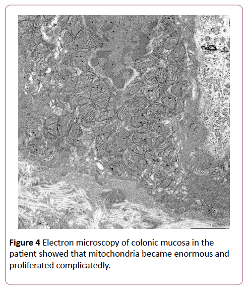 pediatrics-health-research-Electron-microscopy-colonic
