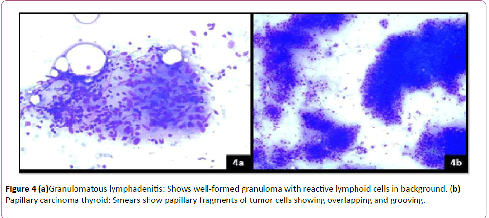 pediatrics-health-research-Granulomatous