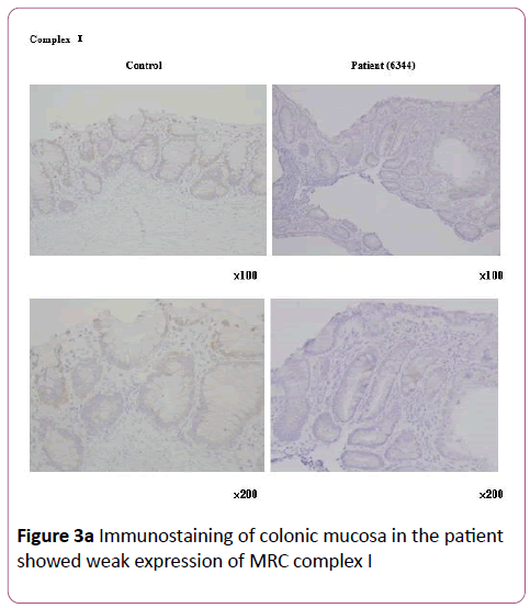 pediatrics-health-research-Immunostaining-colonic-mucosa