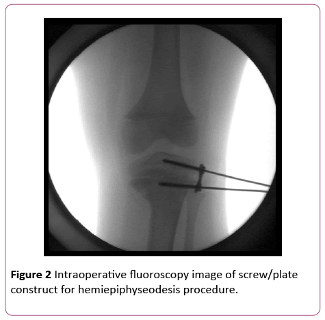 pediatrics-health-research-Intraoperative-fluoroscopy