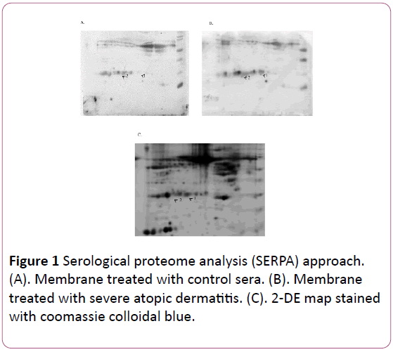 pediatrics-health-research-Serological-proteome-analysis