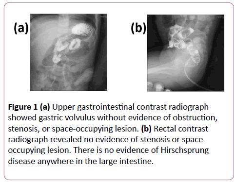 pediatrics-health-research-Upper-gastrointestinal-contrast-radiograph