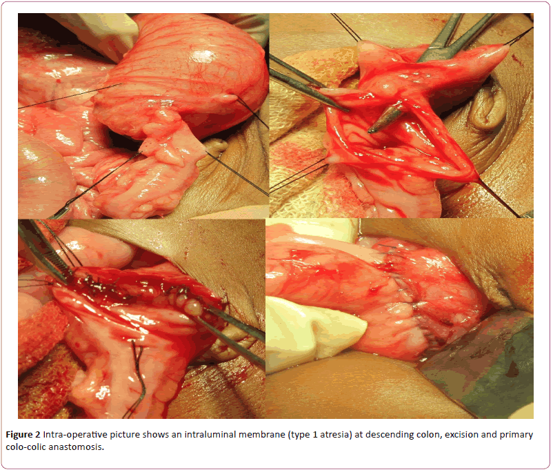 pediatrics-health-research-intraluminal-membrane