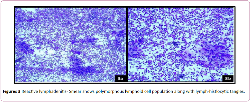 pediatrics-health-research-polymorphous