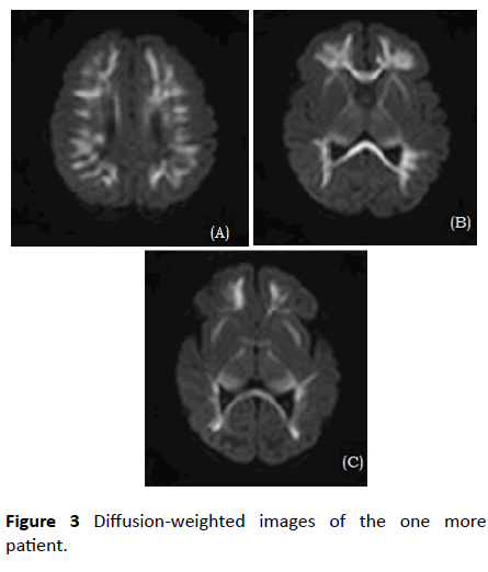 pediatrics-health-research-weighted-images