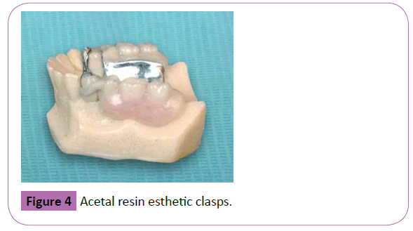 periodontics-prosthodontics-Acetal-resin