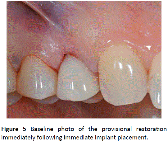 periodontics-prosthodontics-Baseline-photo