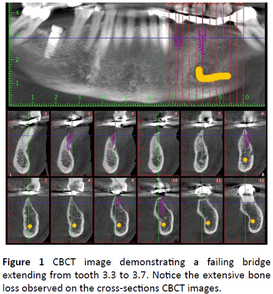 periodontics-prosthodontics-CBCT-image