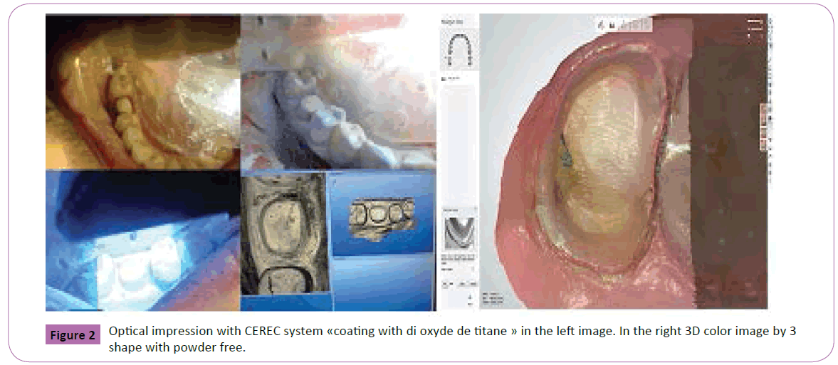 periodontics-prosthodontics-CEREC-system