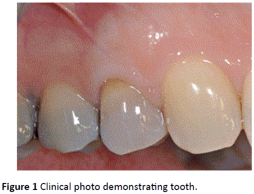 periodontics-prosthodontics-Clinical-photo