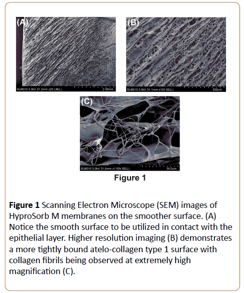 periodontics-prosthodontics-Electron-Microscope